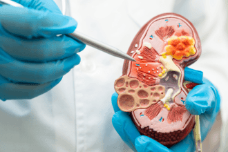 Descubra com Alexandre Costa Pedrosa como o exercício físico pode prevenir doenças crônicas e transformar sua saúde.