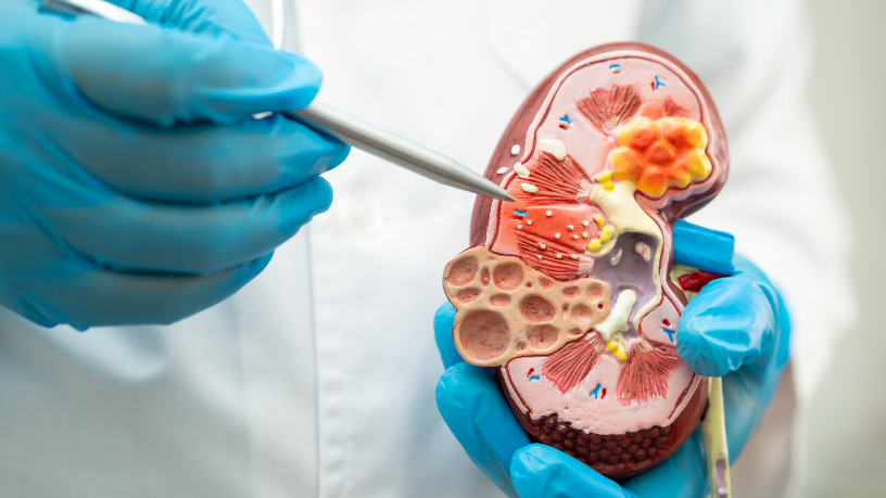 Descubra com Alexandre Costa Pedrosa como o exercício físico pode prevenir doenças crônicas e transformar sua saúde.